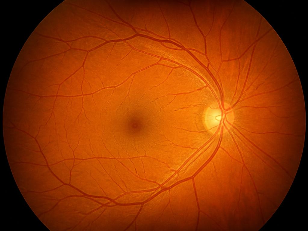 Retinografia colorida evidenciando a vascularização retiniana